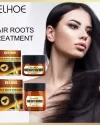 Eelhoe Hair Roots Treatment