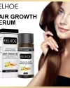 Eelhoe Hair Ginger Oil