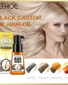 Eelhoe Black Castor Oil For Black Hair